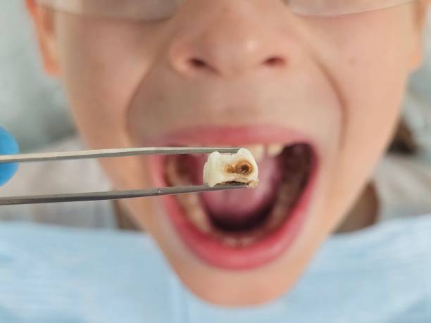 Best Emergency Denture Repair in Bluff City, TN